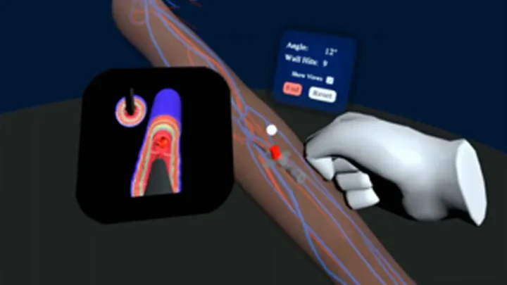 XR Cannulation